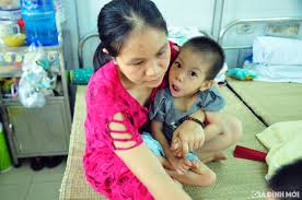 Bại não thể co cứng chữa được hay không phụ thuộc vào nhiều yếu tố
